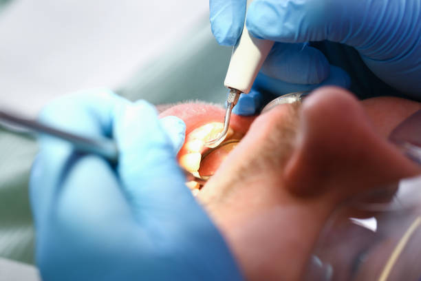 Best Pediatric Emergency Dentist in Tuckahoe, NY