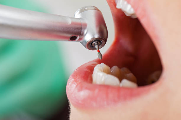 Best Urgent Care for Lost Fillings or Crowns in Tuckahoe, NY